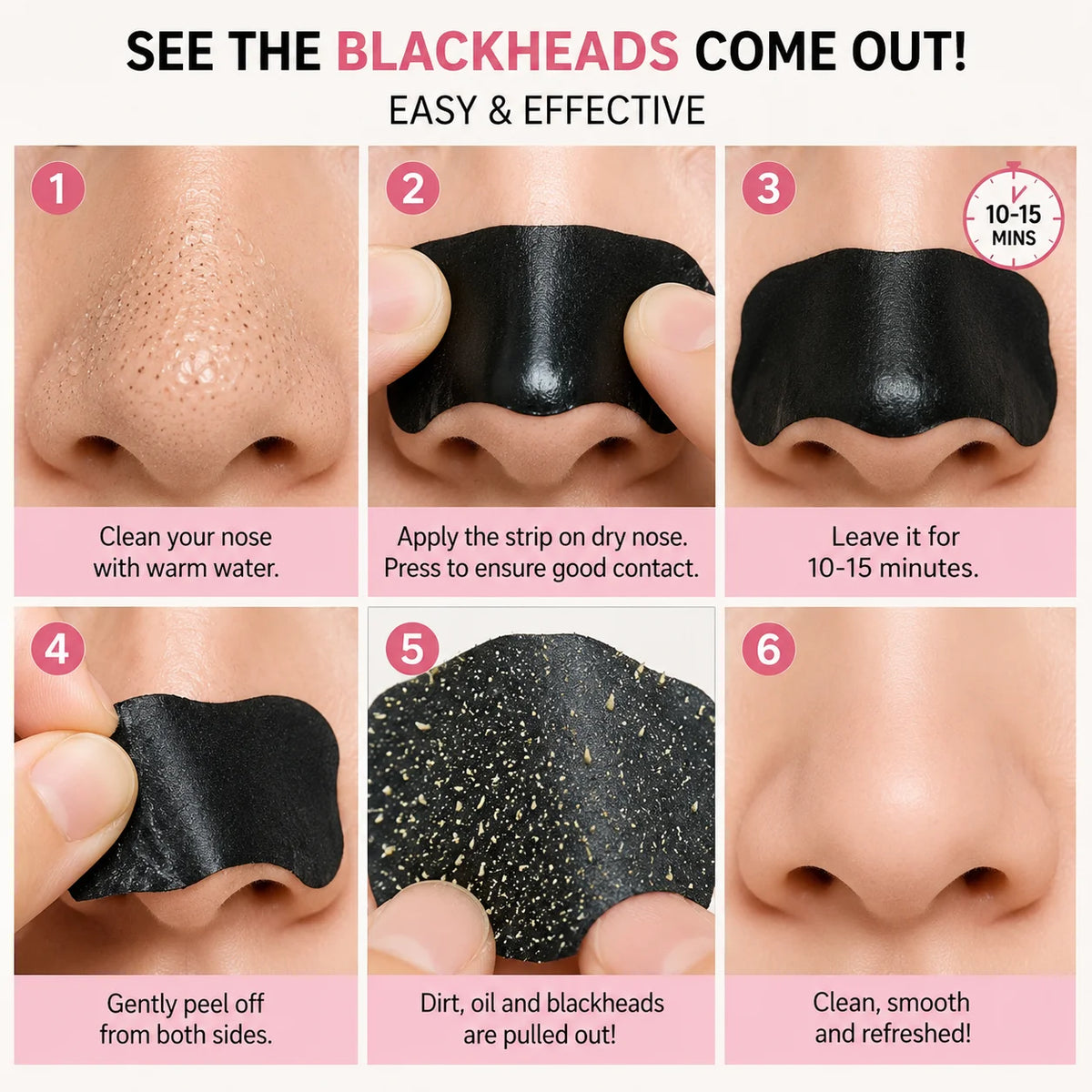580Pcs 2 In 1 Nose Strip And Face Dot Set, Blackhead Nose Patch With Round Face Stickers Beauty Combo Pack